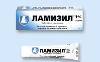 Способы лечения грибка стопы