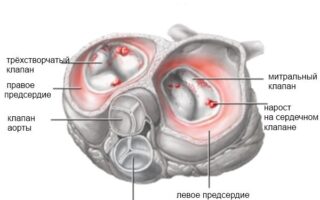 Как устранить сыпь на стопе: лечение и профилактика